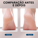 Lixa Elétrica Removedor de Calos  Max-Pro